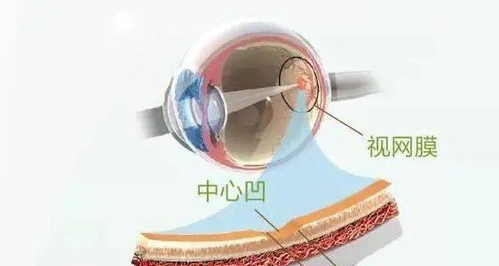 如何通过电脑模糊照片来修复眼睛效果（技巧、步骤和关键点，一篇教程帮助您恢复清晰明亮的眼睛）